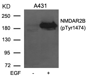 Rabbit Polyclonal Antibody to NMDAR2B(phospho-Tyr1474)
