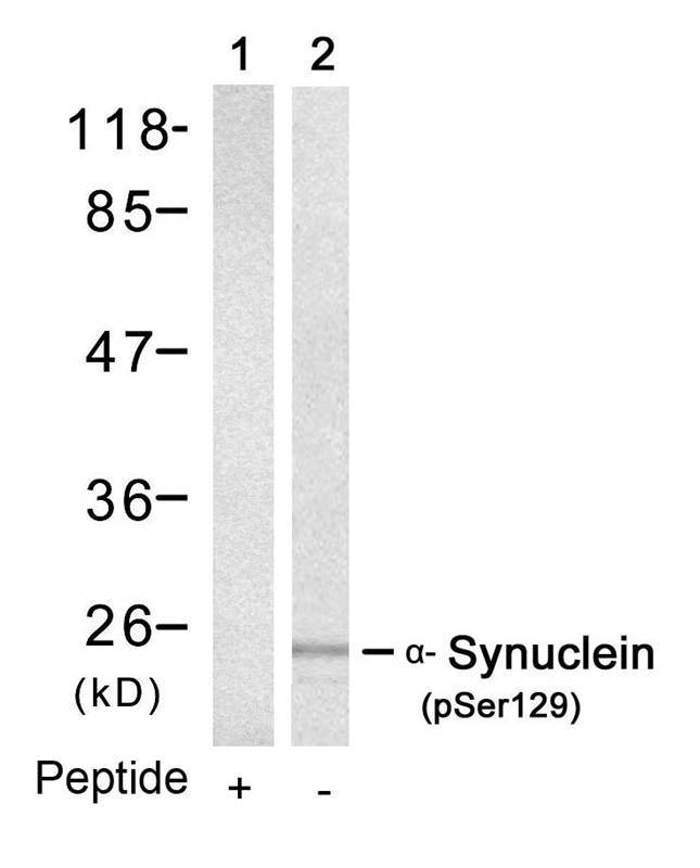Rabbit Polyclonal Antibody to a-Synuclein(Phospho-Ser129)