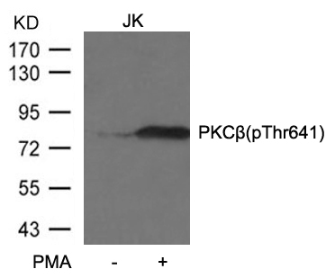 Rabbit Polyclonal Antibody to PKCb(Phospho-Thr641)