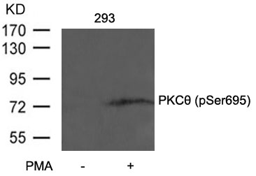 Rabbit Polyclonal Antibody to PKCth(Phospho-Ser695)