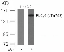 Rabbit Polyclonal Antibody to PLCg2(Phospho-Tyr753)