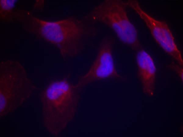 Rabbit Polyclonal Antibody to SEK1/MKK4(Phospho-Thr261)