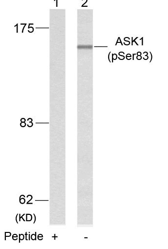 Rabbit Polyclonal Antibody to ASK1(Phospho-Ser83)