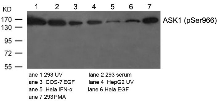 Rabbit Polyclonal Antibody to ASK1(Phospho-Ser966)