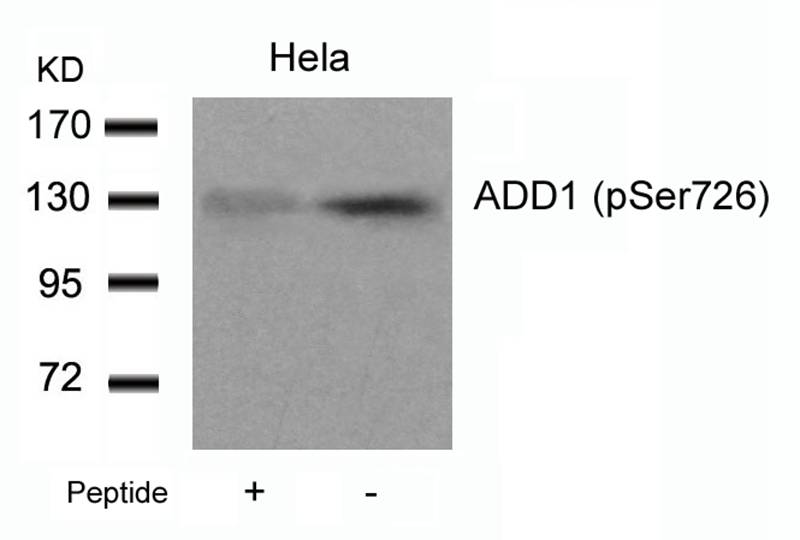 Rabbit Polyclonal Antibody to ADD1(Phospho-Ser726)