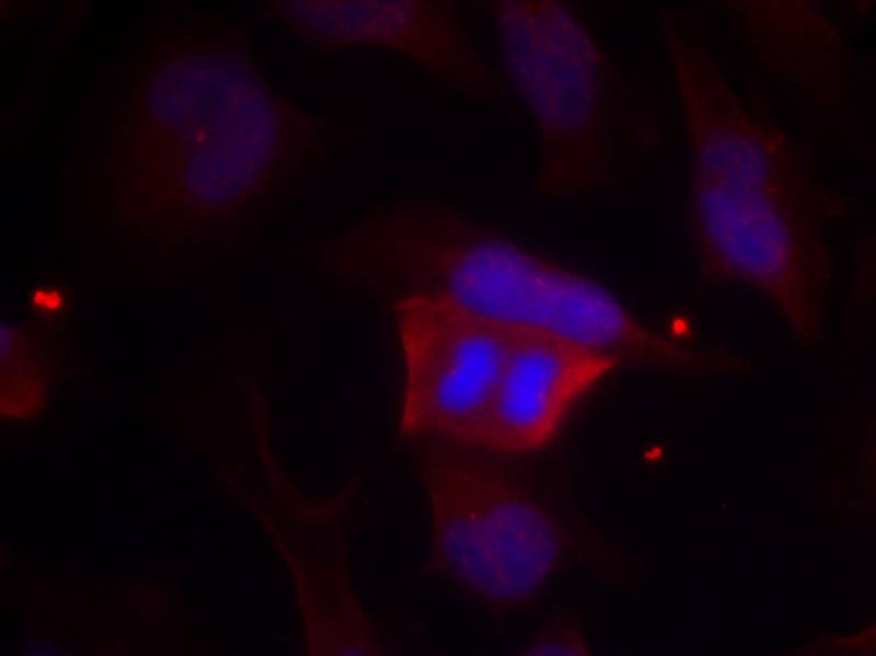 Rabbit Polyclonal Antibody to DARPP-32(Phospho-Thr75)
