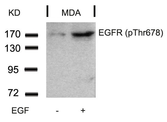 Rabbit Polyclonal Antibody to EGFR(Phospho-Thr678)