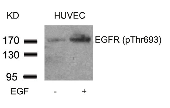 Rabbit Polyclonal Antibody to EGFR(Phospho-Thr693)