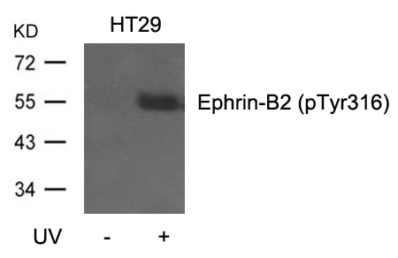 Rabbit Polyclonal Antibody to Ephrin-B2(Phospho-Tyr316)