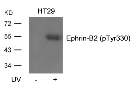 Rabbit Polyclonal Antibody to Ephrin-B2(Phospho-Tyr330)