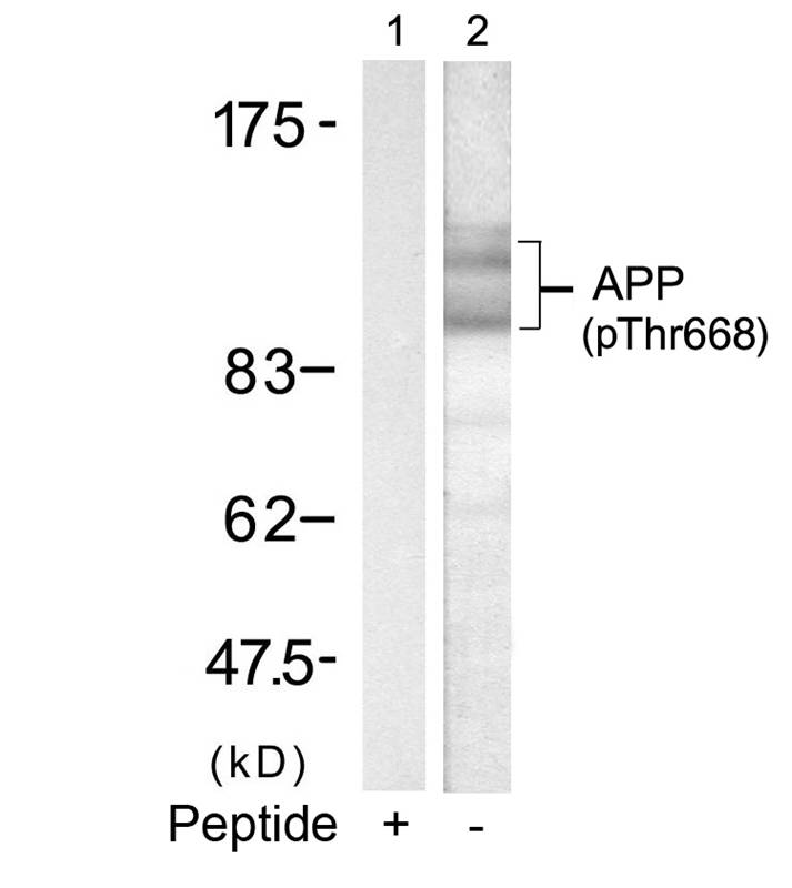 Rabbit Polyclonal Antibody to APP(Phospho-Thr668)