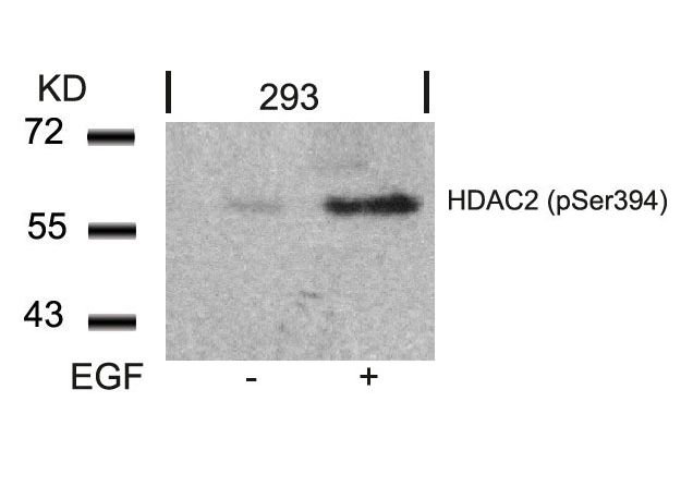 Rabbit Polyclonal Antibody to HDAC2(Phospho-Ser394)