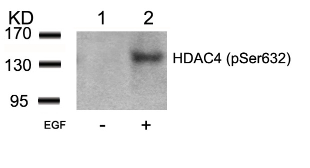 Rabbit Polyclonal Antibody to HDAC4(Phospho-Ser632)