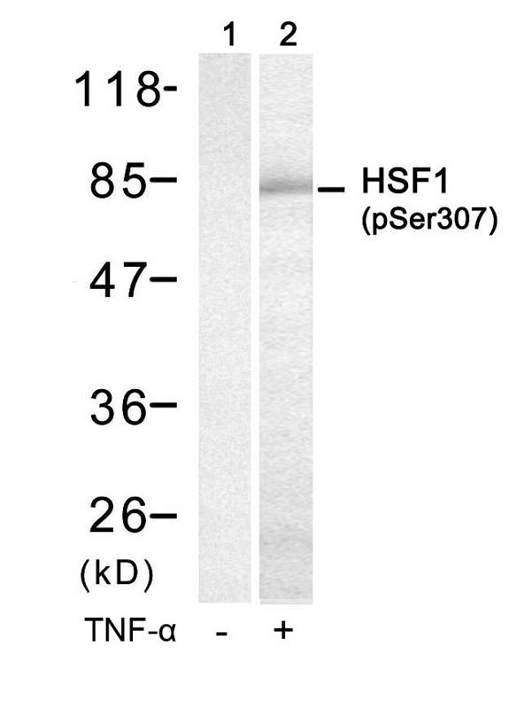 Rabbit Polyclonal Antibody to HSF1(Phospho-Ser307)