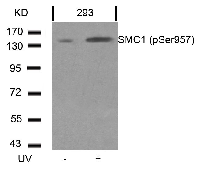 Rabbit Polyclonal Antibody to SMC1(Phospho-Ser957)