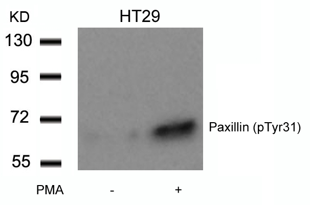 Rabbit Polyclonal Antibody to Paxillin(Phospho-Tyr31)