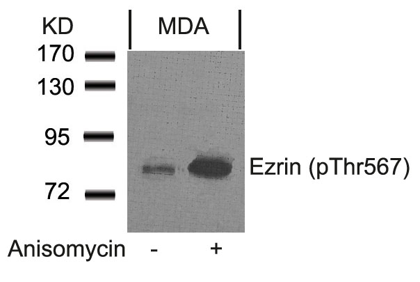 Rabbit Polyclonal Antibody to Ezrin(Phospho-Thr567)