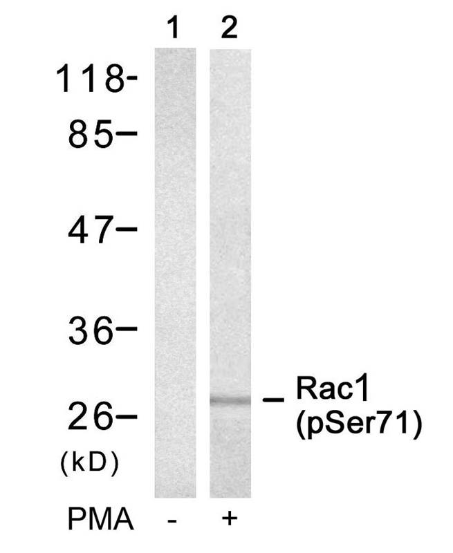 Rabbit Polyclonal Antibody to Rac1(Phospho-Ser71)