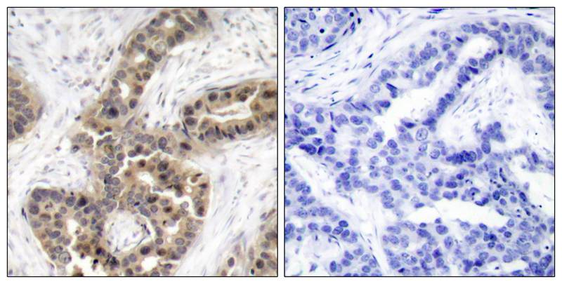 Rabbit Polyclonal Antibody to p21Cip1(Phospho-Thr145)