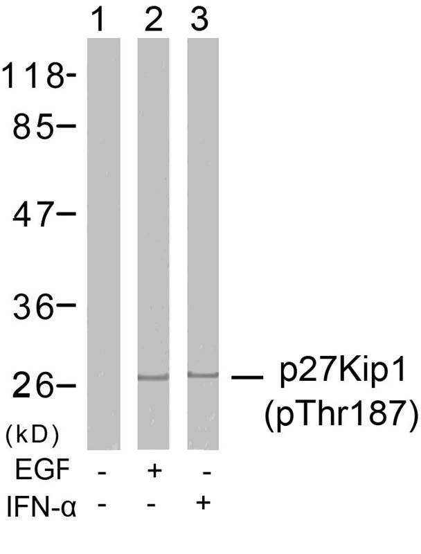 Rabbit Polyclonal Antibody to p27Kip1(Phospho-Thr187)
