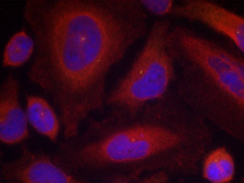 Rabbit Polyclonal Antibody to Synaptotagmin 1 (Phospho-Ser309)