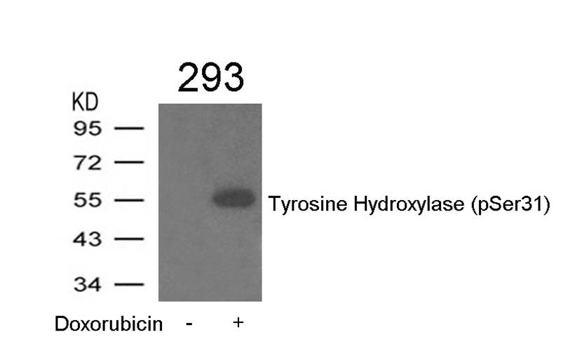 Rabbit Polyclonal Antibody to Tyrosine Hydroxylase(Phospho-Ser31)