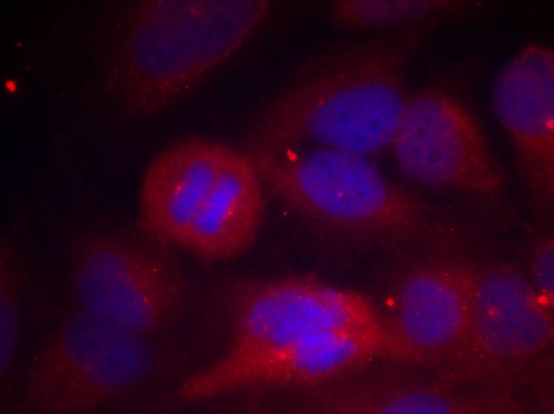 Rabbit Polyclonal Antibody to Tyrosine Hydroxylase(Phospho-Ser40)