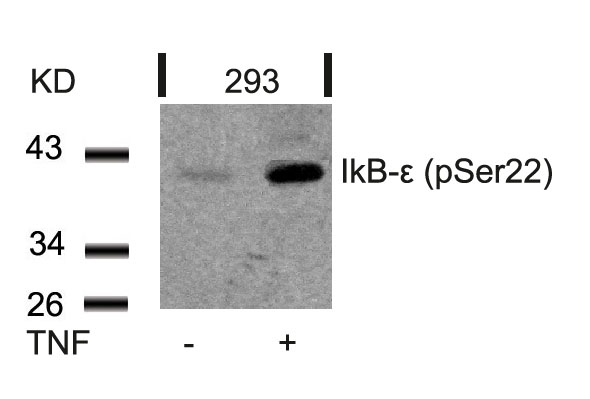 Rabbit Polyclonal Antibody to IkB-e(Phospho-Ser22)