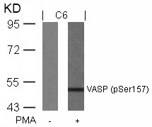 Rabbit Polyclonal Antibody to VASP(Phospho-Ser157)