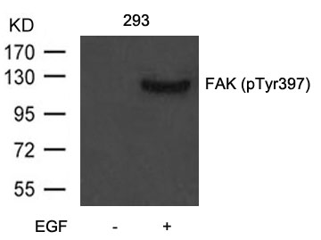 Rabbit Polyclonal Antibody to FAK(Phospho-Tyr397)