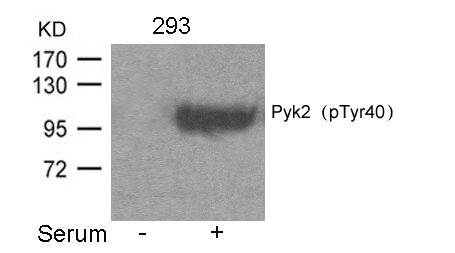 Rabbit Polyclonal Antibody to Pyk2(Phospho-Tyr402)