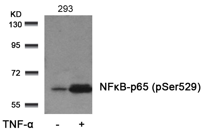 Rabbit Polyclonal Antibody to NFkB-p65(Phospho-Ser529)