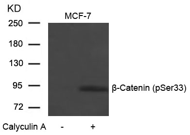 Rabbit Polyclonal Antibody to b-Catenin(Phospho-Ser33)