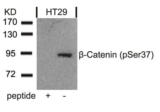 Rabbit Polyclonal Antibody to b-Catenin(Phospho-Ser37)