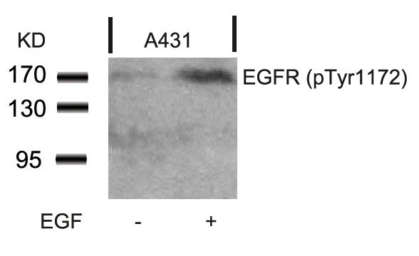 Rabbit Polyclonal Antibody to EGFR(Phospho-Tyr1172)