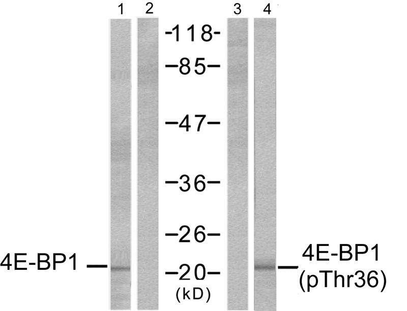 Rabbit Polyclonal Antibody to 4E-BP1(Phospho-Thr37)