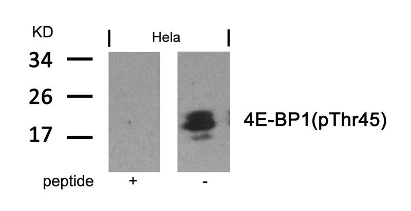Rabbit Polyclonal Antibody to 4E-BP1(Phospho-Thr46)