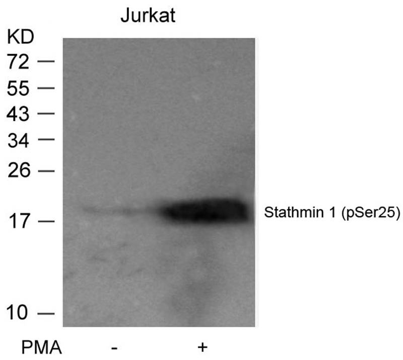 Rabbit Polyclonal Antibody to Stathmin1(Phospho-Ser25)