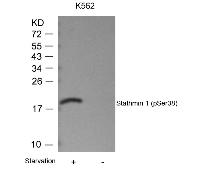 Rabbit Polyclonal Antibody to Stathmin1(Phospho-Ser38)