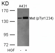 Rabbit Polyclonal Antibody to Met(Phospho-Tyr1234)