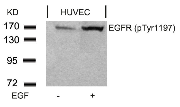 Rabbit Polyclonal Antibody to EGFR(Phospho-Tyr1197)