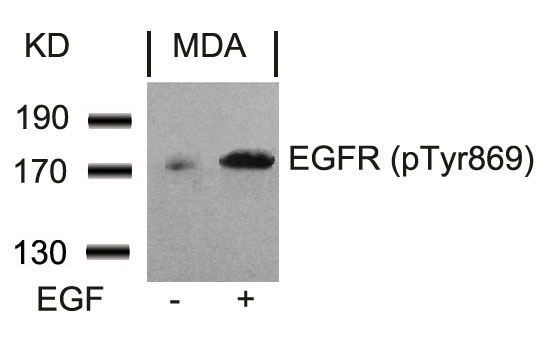 Rabbit Polyclonal Antibody to EGFR(Phospho-Tyr869)