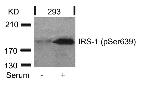 Rabbit Polyclonal Antibody to IRS-1(Phospho-Ser639)