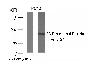 Rabbit Polyclonal Antibody to S6 Ribosomal Protein(Phospho-Ser235)