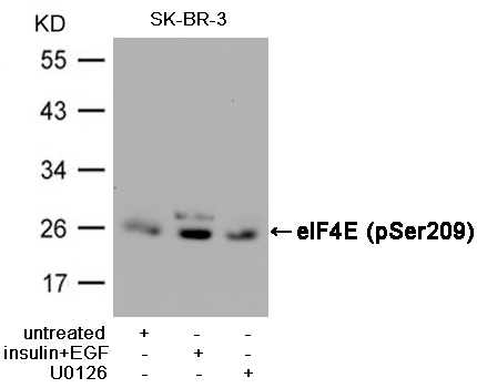 Rabbit Polyclonal Antibody to eIF4E(Phospho-Ser209)