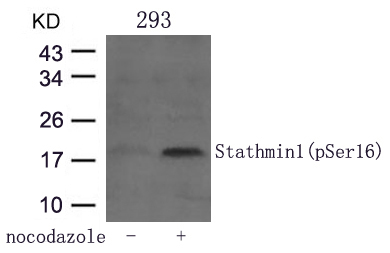 Rabbit Polyclonal Antibody to Stathmin1(Phospho-Ser16)
