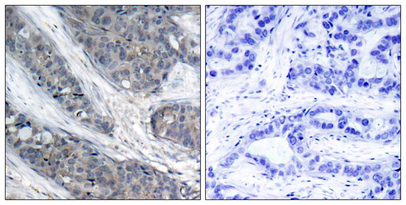 Rabbit Polyclonal Antibody to IRS-1(Phospho-Ser307)