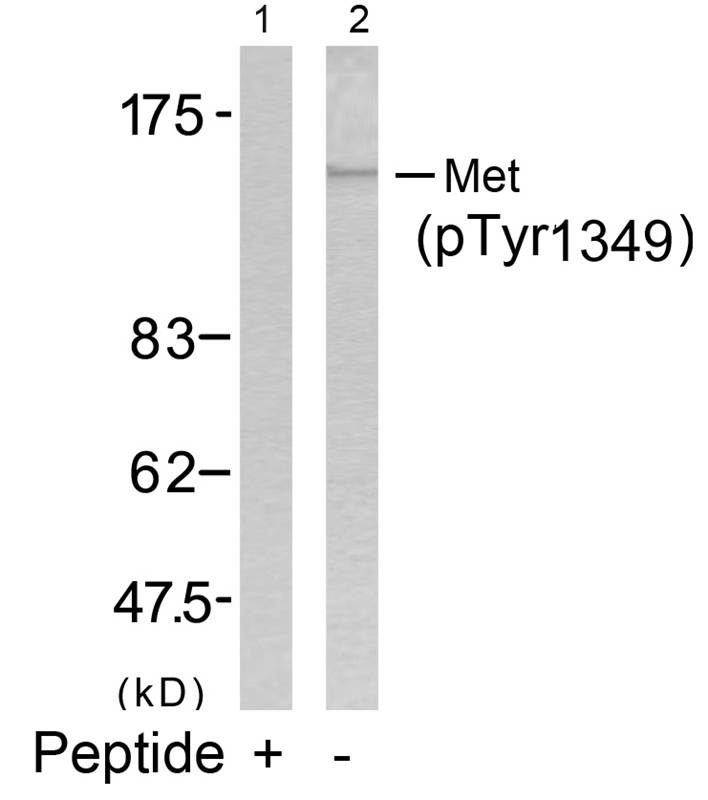 Rabbit Polyclonal Antibody to Met(Phospho-Tyr1349)