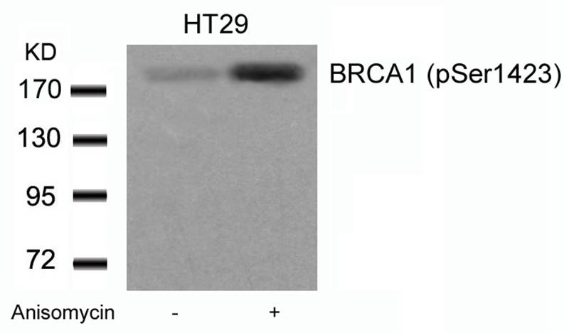 Rabbit Polyclonal Antibody to BRCA1(Phospho-Ser1423)