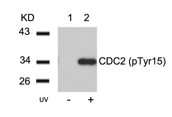 Rabbit Polyclonal Antibody to CDC2(Phospho-Tyr15)